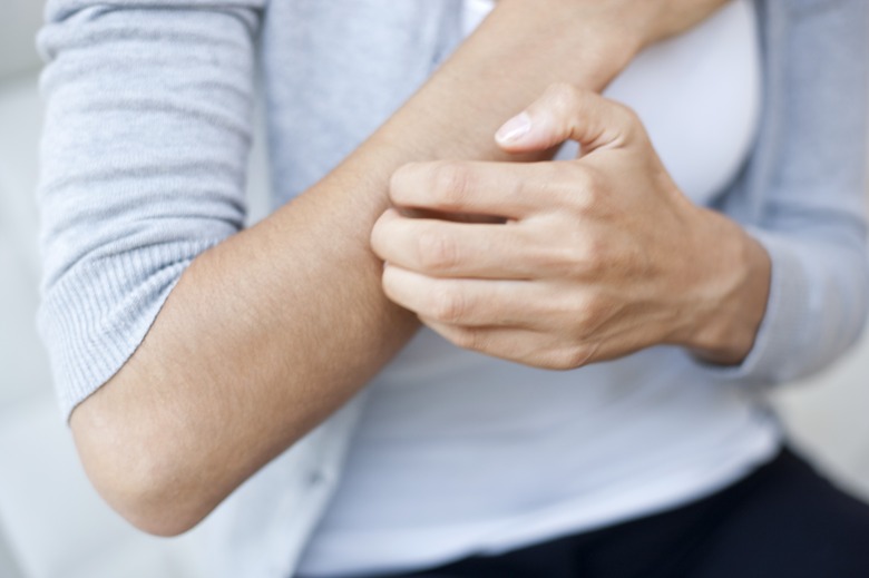 Woman scratching her arm